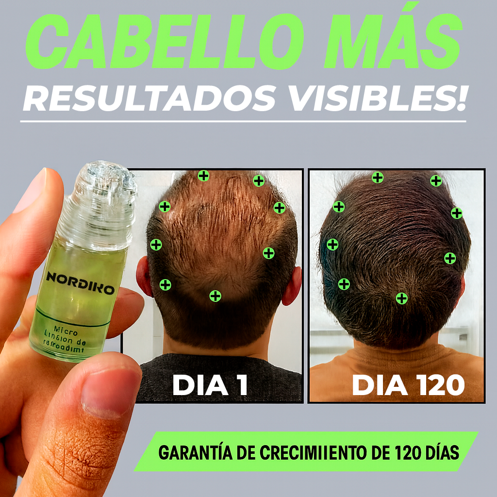 ALPHAGEN™- Sistema de regeneración del cabello
