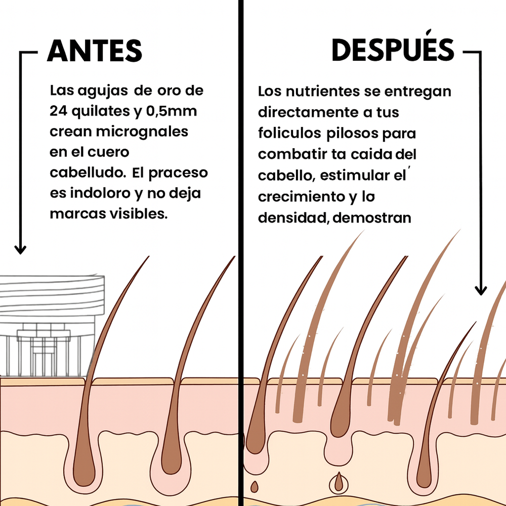 ALPHAGEN™- Sistema de regeneración del cabello