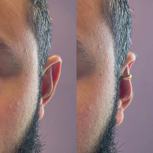 Auralift™ Earrings